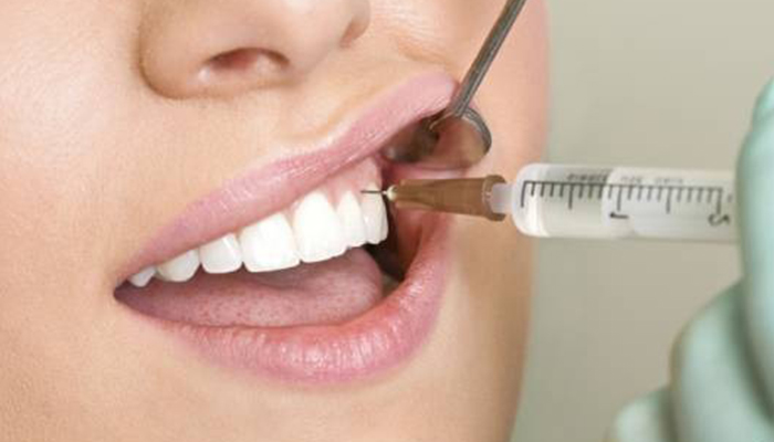 انواع بی حسی مورد استفاده در جراحی دندان