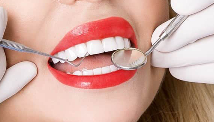 دلایل کاهش طول عمر لمینت دندان